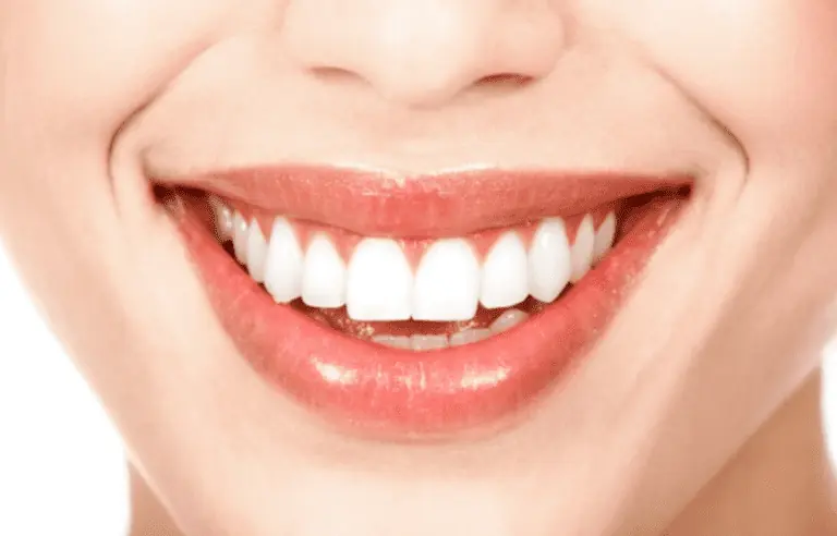 Избелване на зъбите по естествен път – възможно ли е?