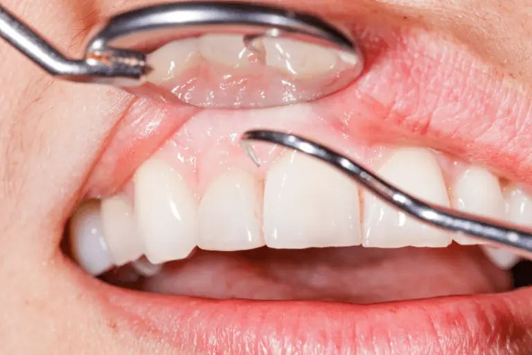 Ключът към здравите зъби е редовната профилактика
