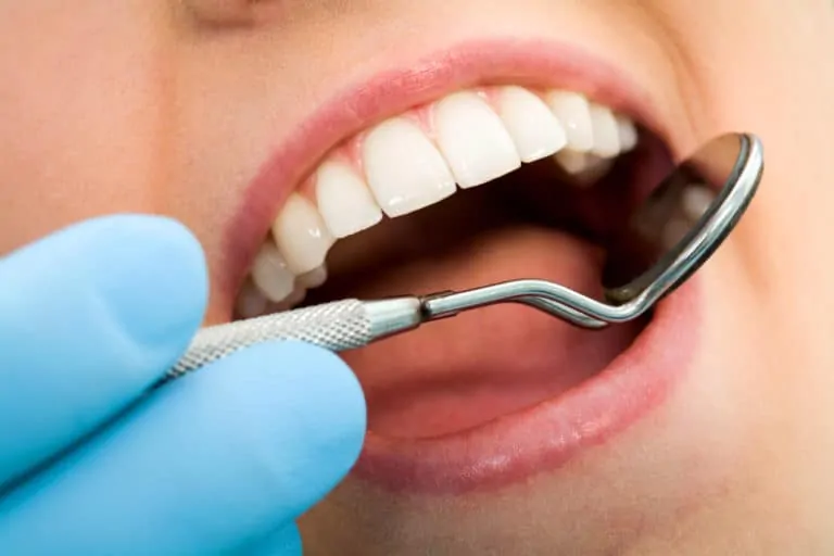 Преглед при зъболекар – задължителен след лятото