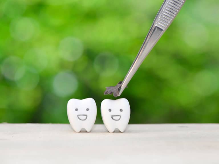 причини за кариес