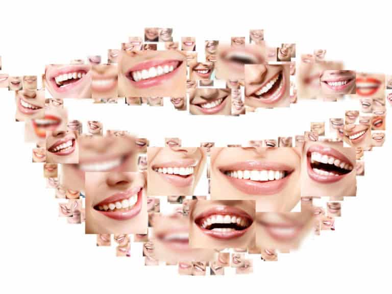 плака по зъбите