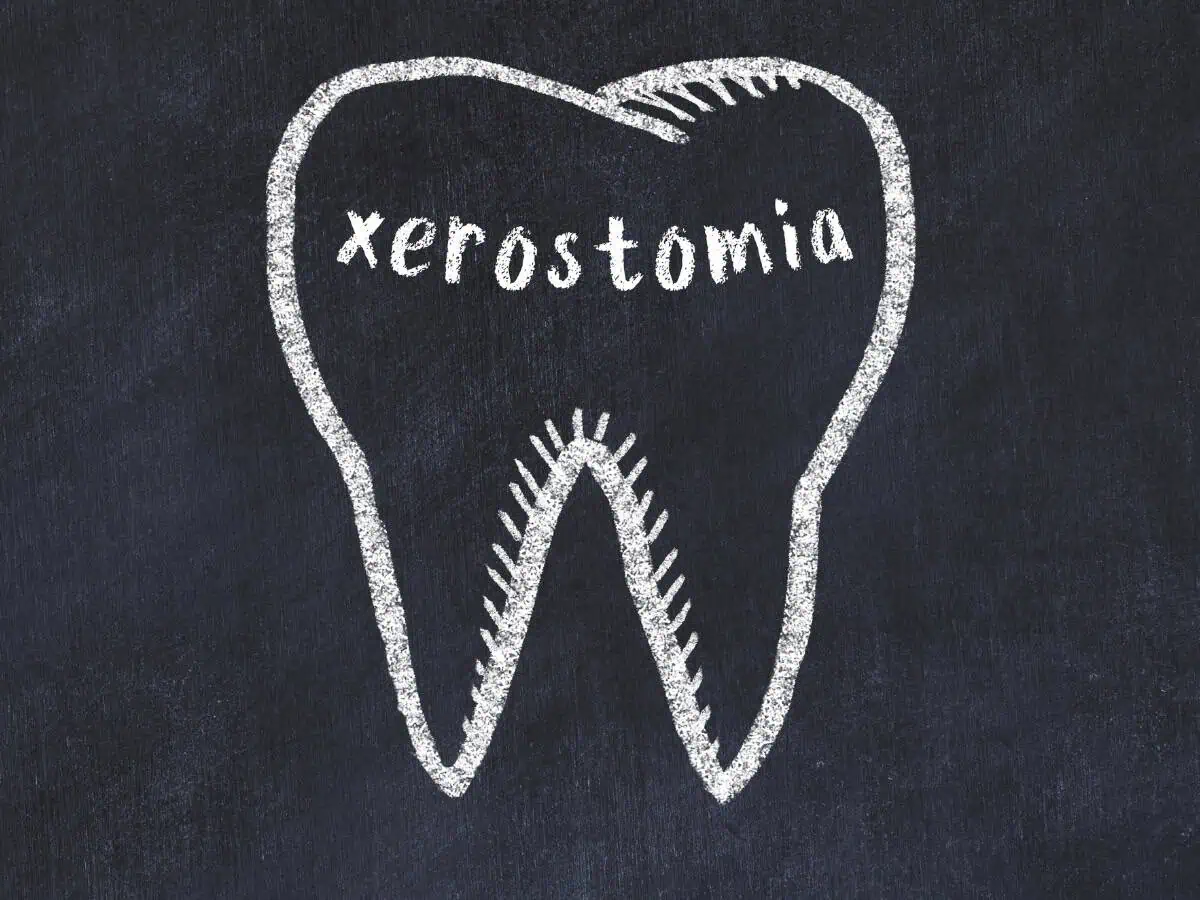 сухота в устата