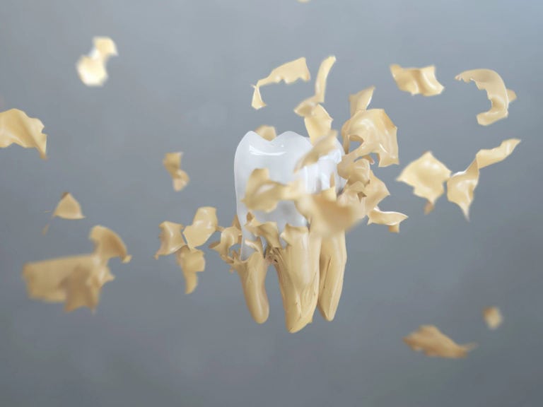 как да премахна зъбната плака