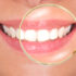 Как да имам по-бели зъби