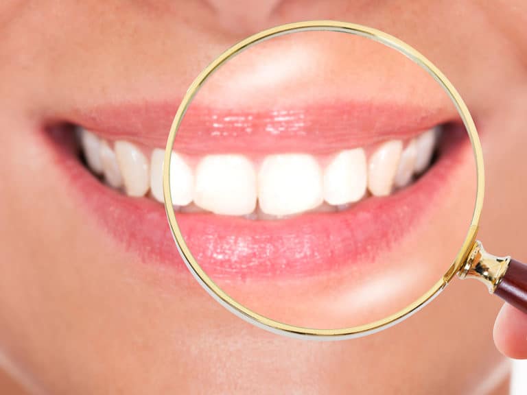 Как да имам по-бели зъби