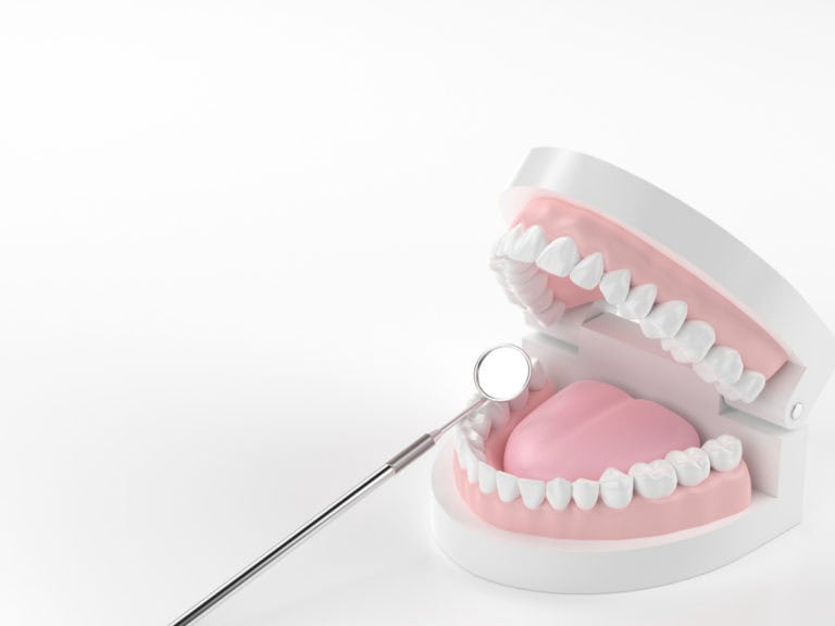 Профилактиката на пародонтоза